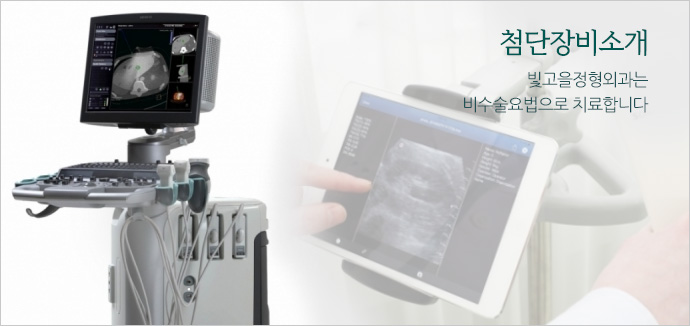 ÷�����ȳ�